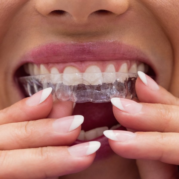 https://www.valerizahnarztpraxis.com/43-large_default/orthodontics-for-adults-with-invisalign.jpg